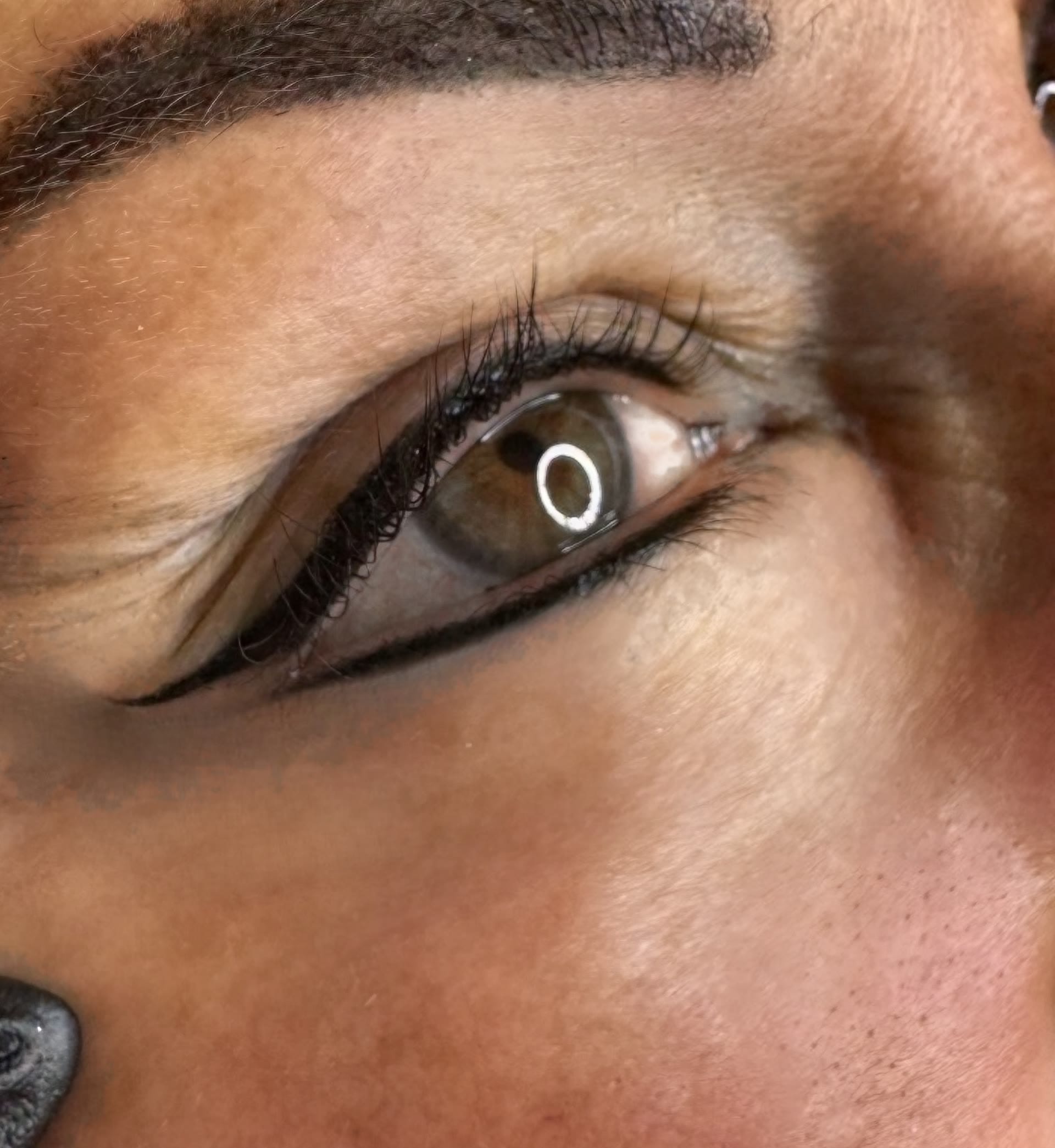 Permanent Make-Up Entfernung mit Remover-Technik in Michelfeld