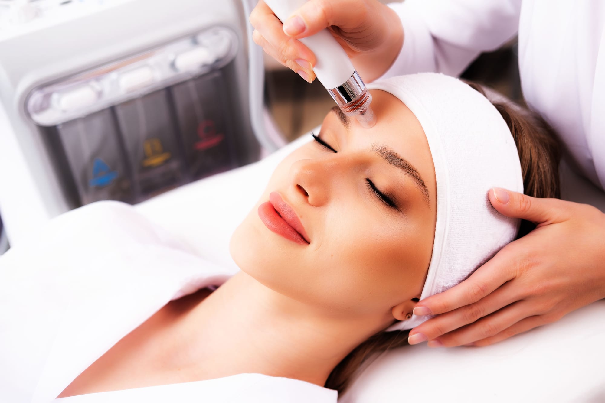 RF Microneedling Hautverjüngung in Michelfeld bei Schwäbisch Hall