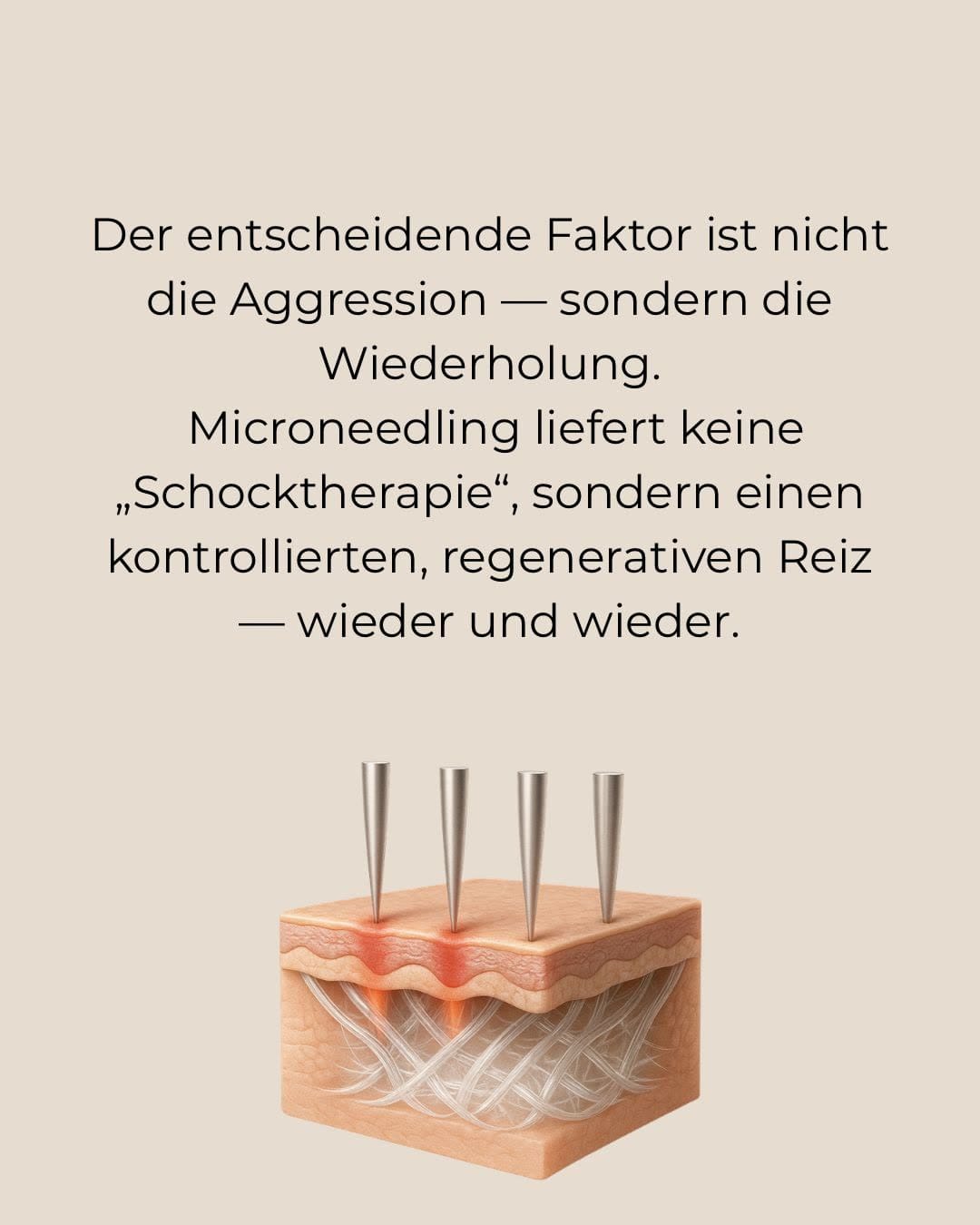 So funktioniert RF Microneedling – Infografik